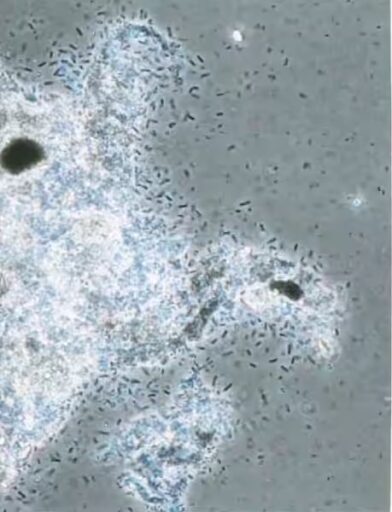 Evaluating the Biological Health of Your ETP & STP 3 Weak Flocs Under Microscope